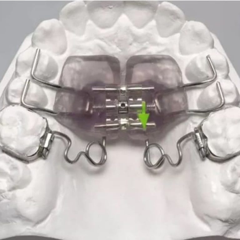 Çənə genişləndirici aparatlar